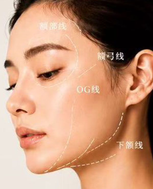 Facial Contouring Treatment