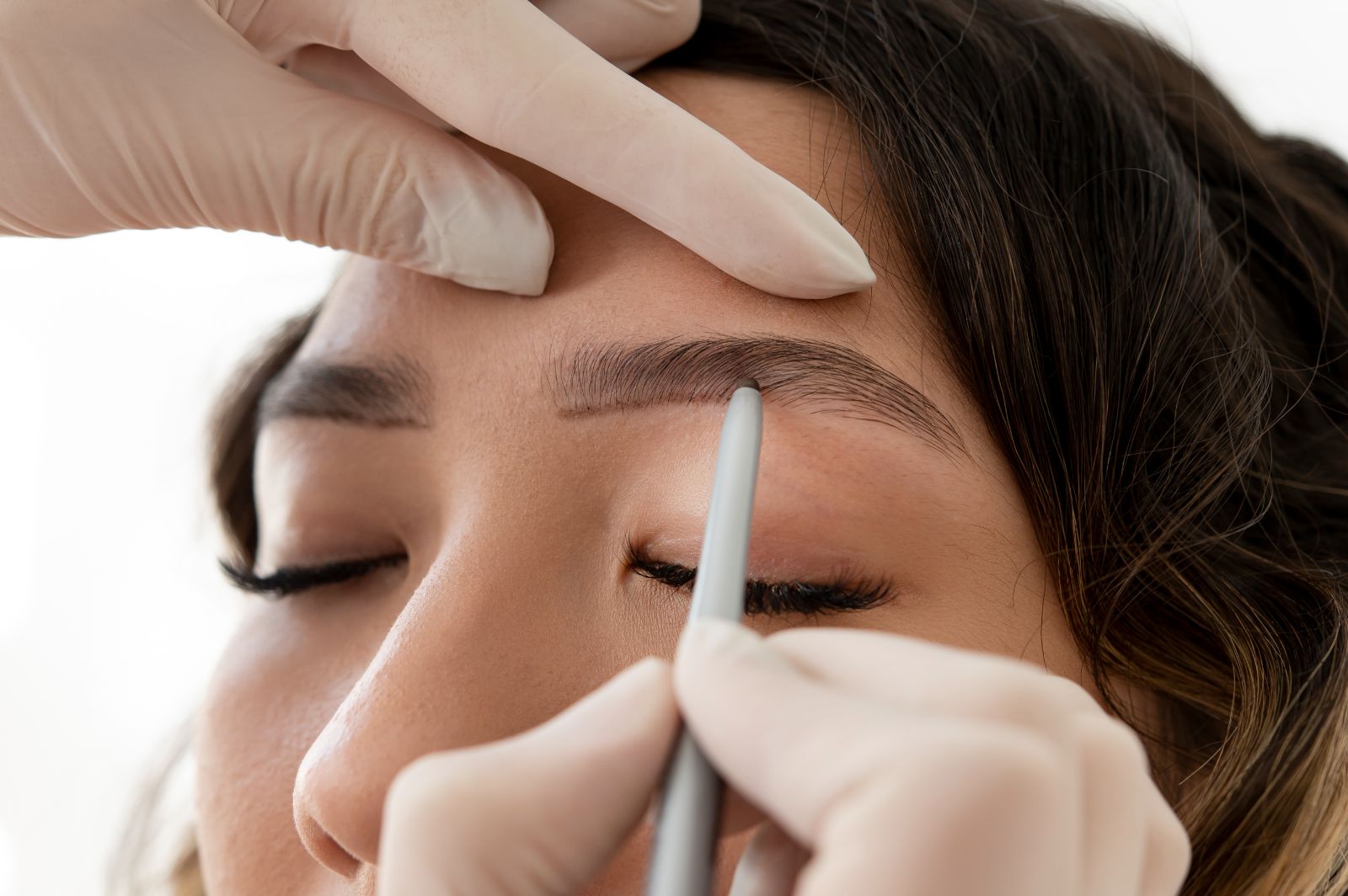 Non-Invasive Hairline Pigment Removal