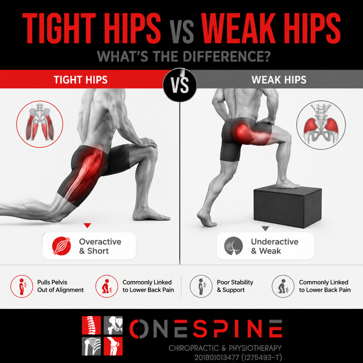 Tight Hips vs Weak Hips: What��s the Difference?