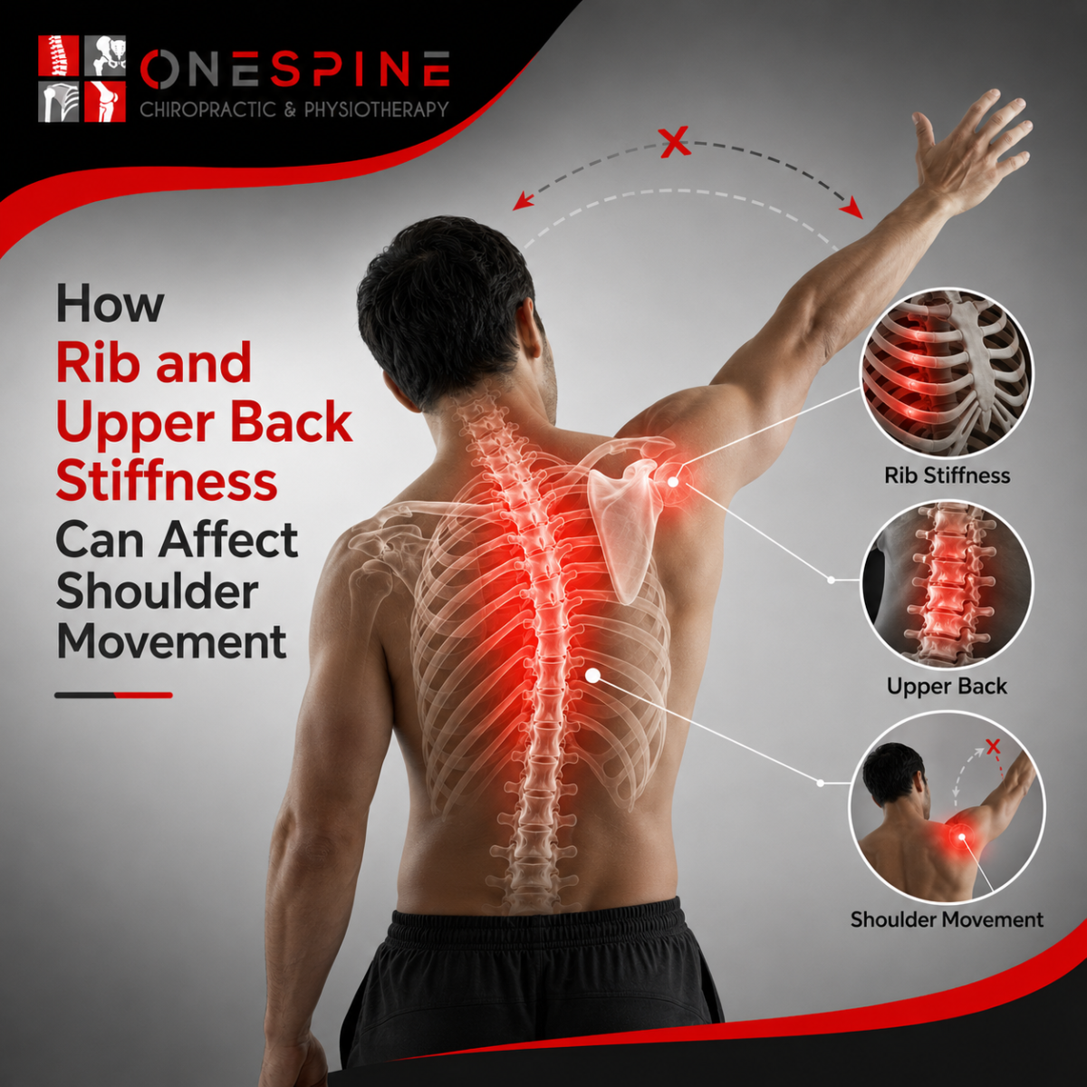 How Rib and Upper Back Stiffness Can Affect Shoulder Movement