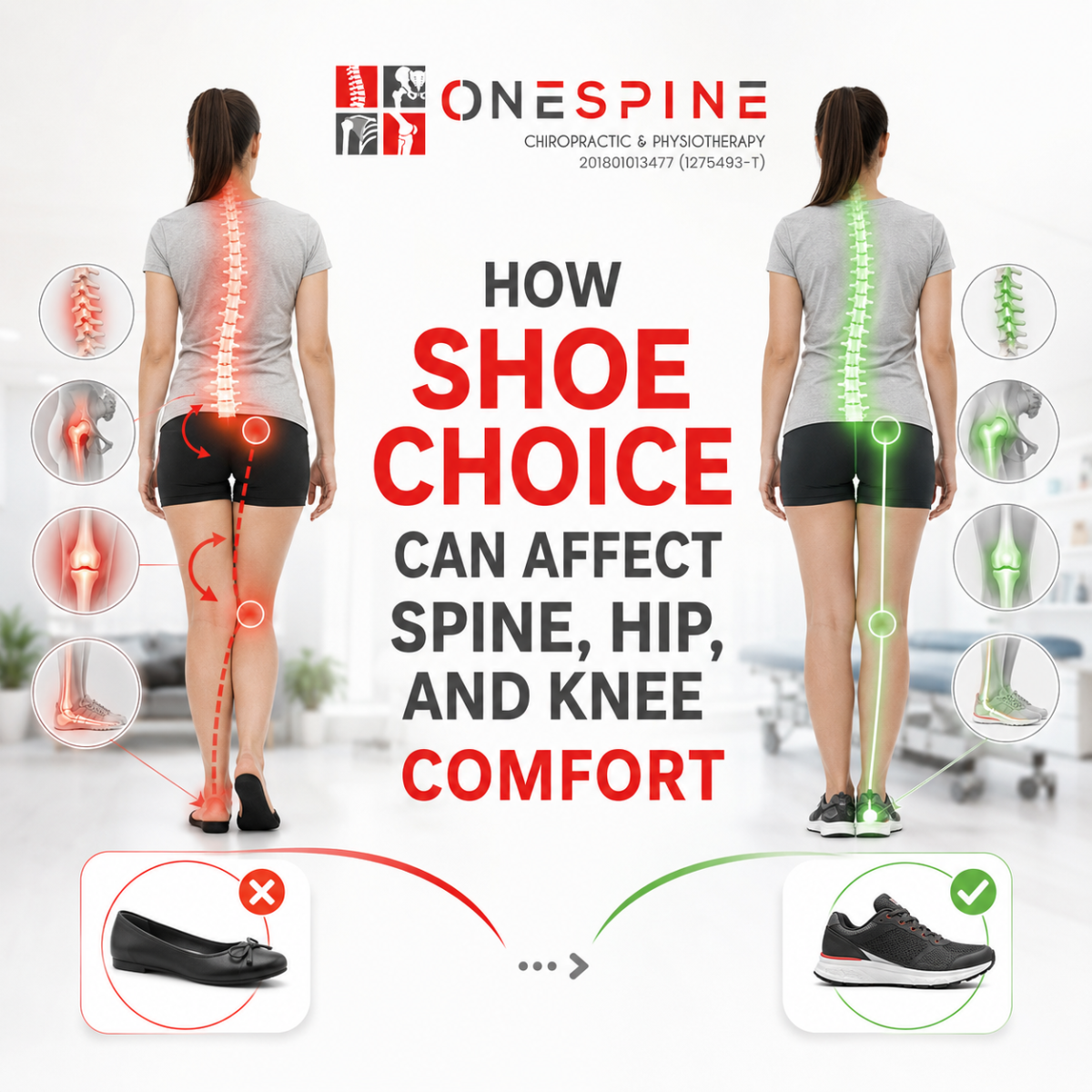 How Shoe Choice Can Affect Spine, Hip, and Knee Comfort