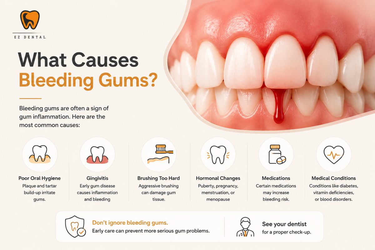 What Causes Bleeding Gums? Causes & When to Worry | EZ Dental
