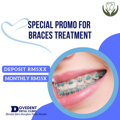 Transform Your Smile With DoveDent's Exclusive Braces Promo 
