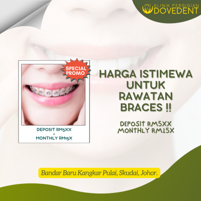 Brace Yourself for a Radiant Smile with DoveDent's Exclusive Braces Promo 