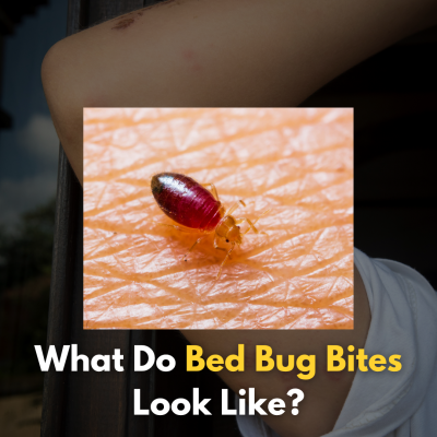 What Do Bed Bug Bites Look Like?