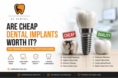 Are Cheap Dental Implants Worth It? The Hidden Risks & Real Costs Explained | Ez Dental Seri Kembangan