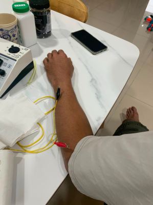 A Single Treatment That Brought Hope Back to His Hand