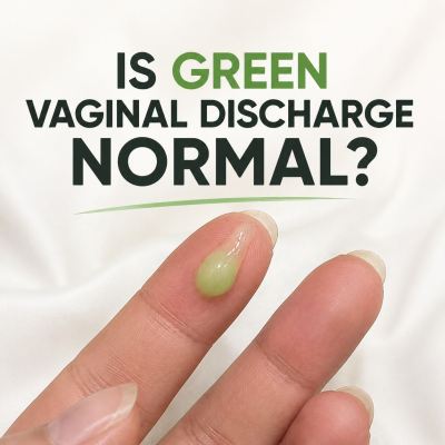  Is Green Vaginal Discharge Normal? What Should You Pay Attention To?