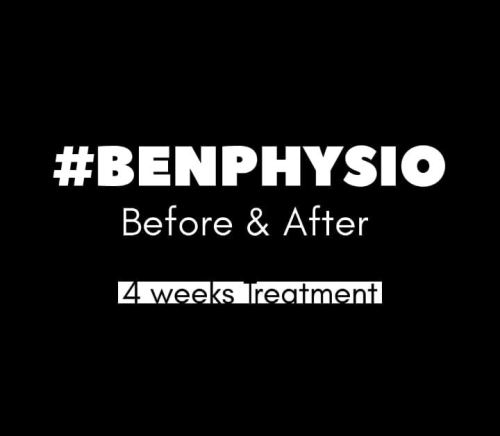 BENPHYSIO : Before & After Treatment