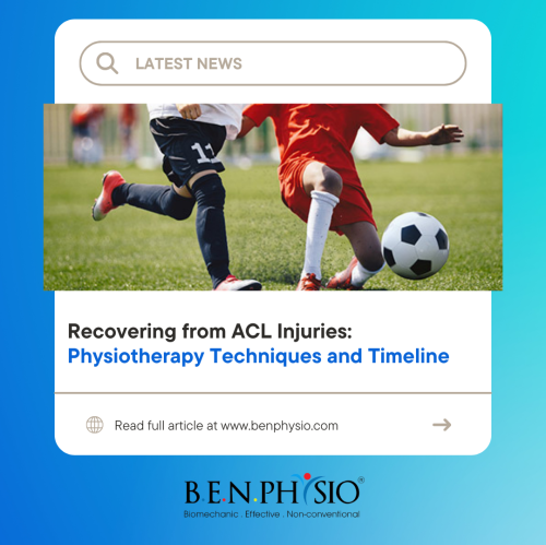 Recovering from ACL Injuries: Physiotherapy Techniques and Timeline
