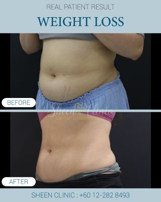 weight management in subang jaya