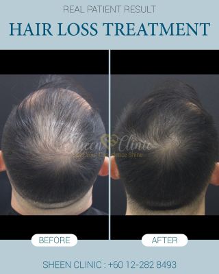 hair treatment in subang jaya