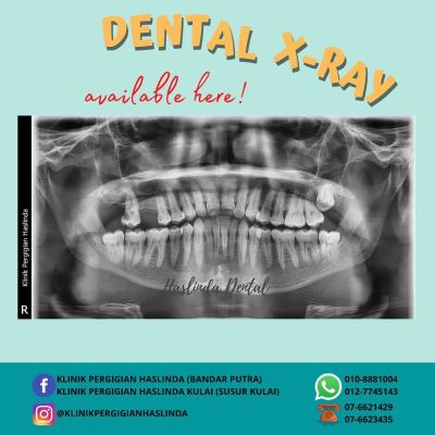 Case 1 Dental X-Ray