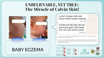 BABY ECZEMA CASE FEEDBACK