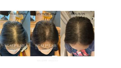Hair Growth Activation Treatment