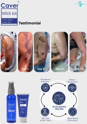 Testimonial