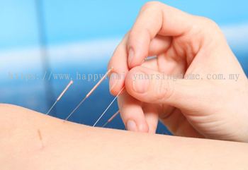 Acupuncture Health Care 针灸保健