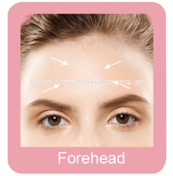 Hair Removal of Forehead