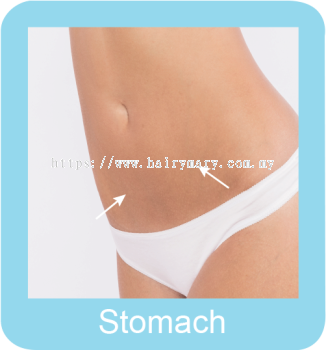 Permanent hair removal stomach