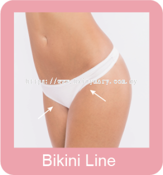 Permanent hair removal bikini line
