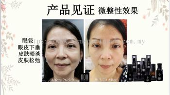 ST Facial Testimony