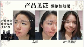 ST Facial Testimony