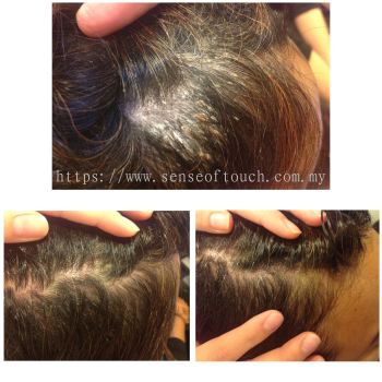 Sense of Touch Scalp Treatment Testimony / ͷƤ & ͷƤ & ͷƤм