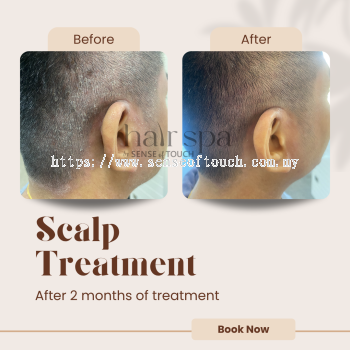 Dry/Itchy Scalp Treatment