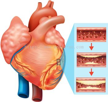 Cardiovascular