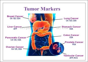 Tumor Markers