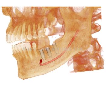 Anatomage Invivo 6