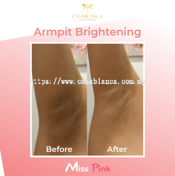 Armpit Whitening