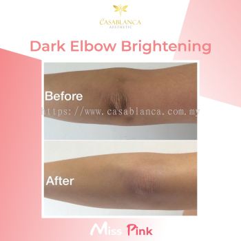 Elbow Whitening