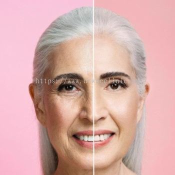 Treatment for Wrinkles