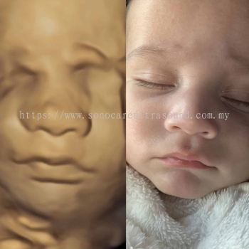 3D / 4D / 5D / 6D Ultrasound Scan