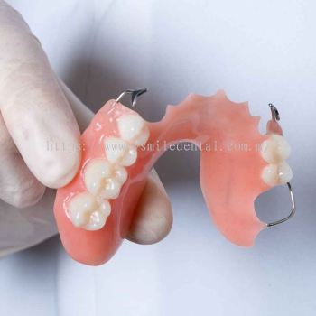 Removable Dentures