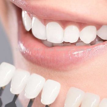 Teeth Whitening Procedures