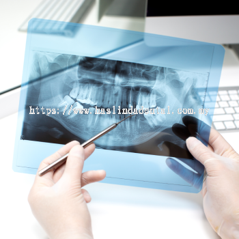 Dental X-Ray & CBCT (3D X-Ray)