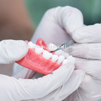 Denture and Flexible Denture