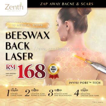 Beeswax Back Laser 