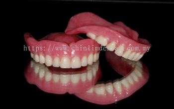 Complete Denture