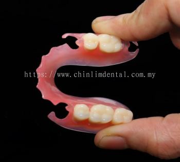 Flexible Denture