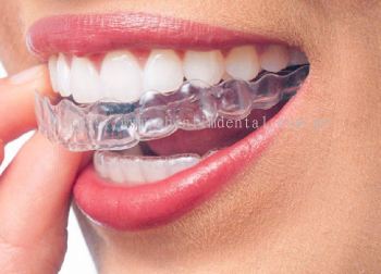 Invisalign