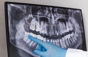 Dental X-Ray