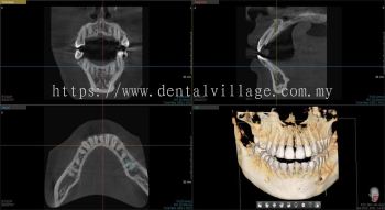 3D CBCT