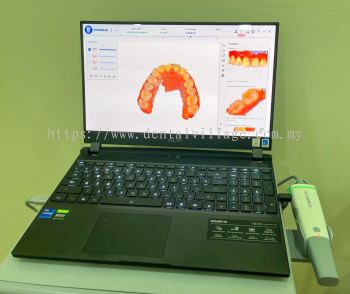 Intraoral 3D Scanner