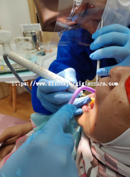 Dental Scaling and Polishing