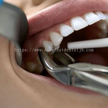 Tooth Extraction Services