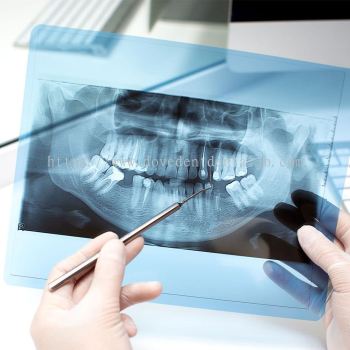 Dental Oral X-Ray (2D/3D)