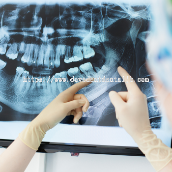 Dental X-Ray Scans